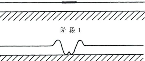 锂离子电池负极涂层气泡缺陷研究